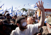 Freed Hostage Alon Ohel Plays Piano on Israeli Sketch Comedy Show ‘Eretz Nehederet’ Former hostage Alon Ohel, wearing an eye patch, waves to supporters during a homecoming celebration on October 24, 2025 in Lavon, Israel.