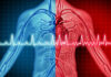 Protect Your Heart and Brain by Knowing the Signs and Symptoms of AFib A graphic representing AFib